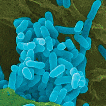 Imagen: Burkholderia pseudomallei (Fotografía cortesía de los Centros para el Control de Enfermedades de los EUA).